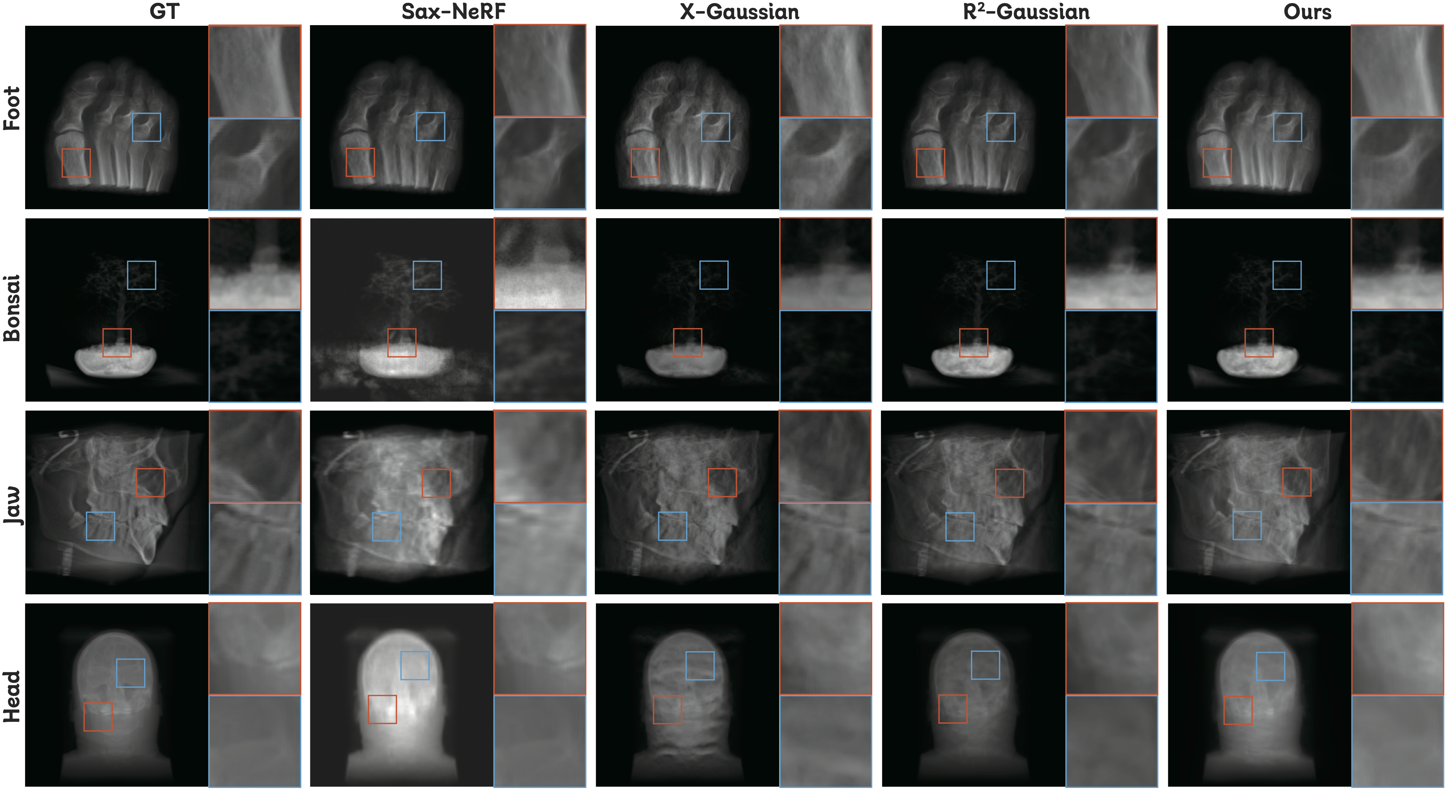 X-ray Novel View Synthesis