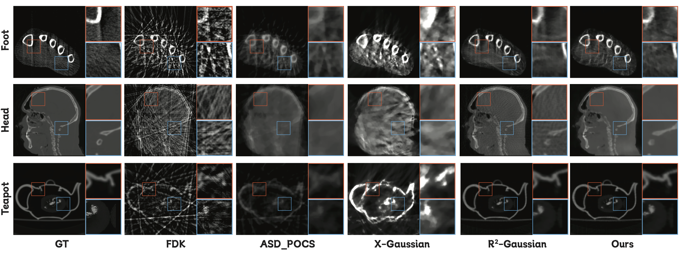 CT Reconstruction